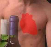 Alkoholická kardiomyopatia, príčiny, príznaky, liečba