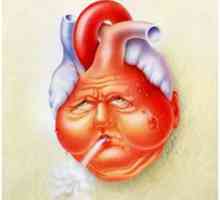 Chronické srdcové zlyhanie
