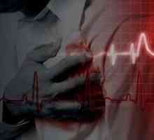 Ischemická choroba srdca a stentu ciev srdca