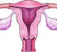 Retenčné cysty na vaječníkoch - príčiny, príznaky, liečba
