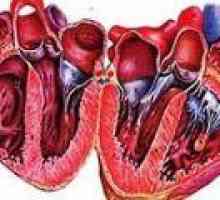 Príznaky a liečba alkoholického kardiomyopatia