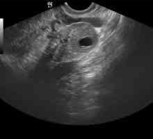 Žlté teliesko vo vaječníku v priebehu tehotenstva