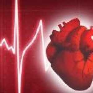 Aký je abnormálny srdcový rytmus?