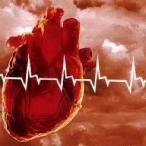 Srdcový infarkt, spôsobí srdcový infarkt