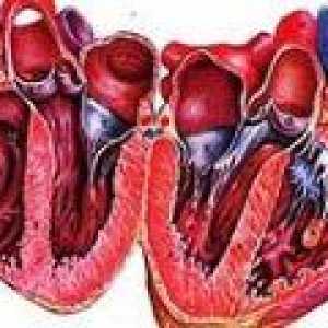 Príznaky a liečba alkoholického kardiomyopatia